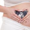 Що дивляться на третьому УЗД при вагітності - норми, розшифровка